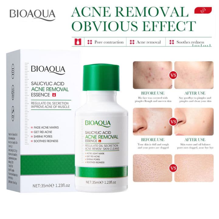 Bioaqua Salicylic Acid Acne Removal Essence - 35ml